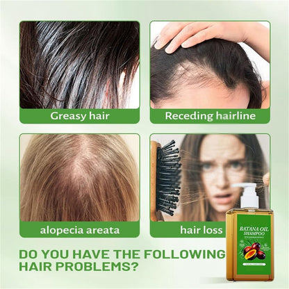 BATANA OILS Shampoo with rosemary extracto. (Hoegoa,100ml)
